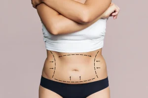 cropped-shot-young-womans-body-with-excess-fat-with-marking-her-belly-liposuction-surgery