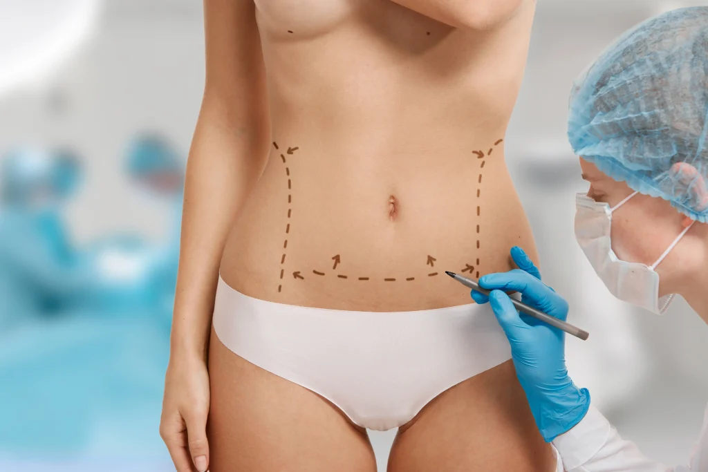 liposuction cost in Colombia
