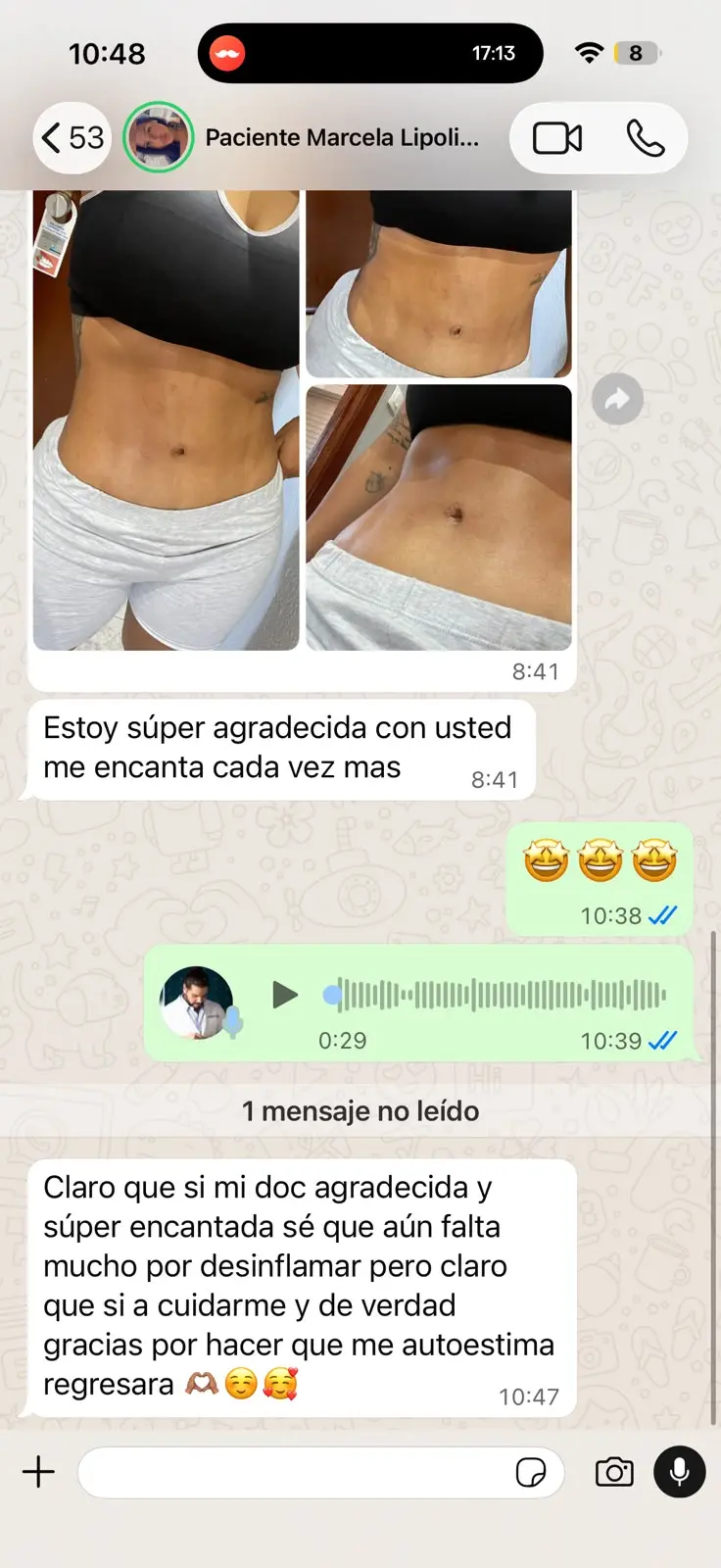 Mensaje de una paciente del Dr. Abraham Medina después de su cirugía 1