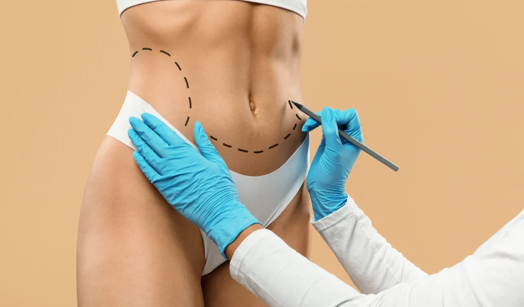 lipoescultura HD